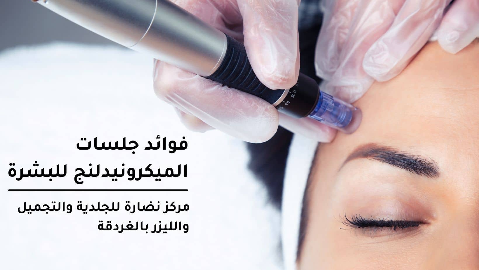 جلسات الميكرونيدلنج للبشرة